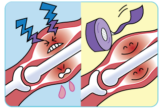 테이핑의 일반적 효과