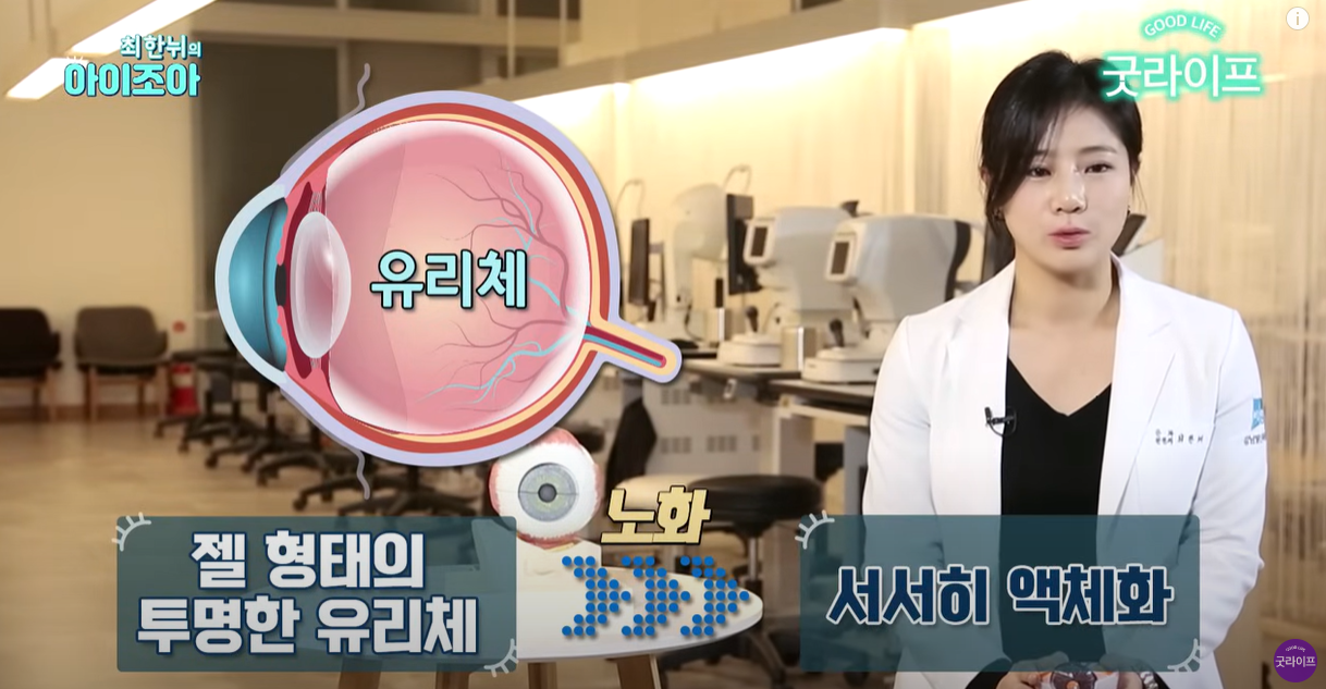 젤리 같은 유리체가 서서히 액화됨