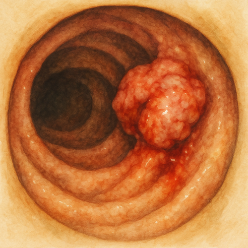 정기점검-대장내시경