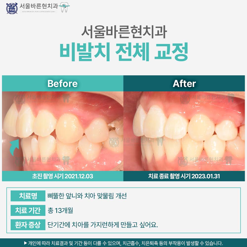 해운대치아교정