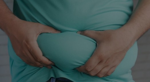 비만기준 - 고도비만기준&#44; 복부비만기준&#44; 소아비만기준