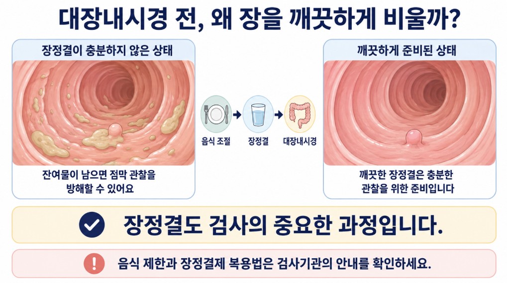 대장내시경 전 장정결이 충분하지 않은 경우와 깨끗하게 준비된 경우를 비교해 대장 점막 관찰에 미치는 차이를 설명한 이미지