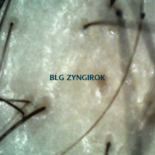 피나모아 복용 27주차 - 정수리와 이마 사이 두피 모습이다.