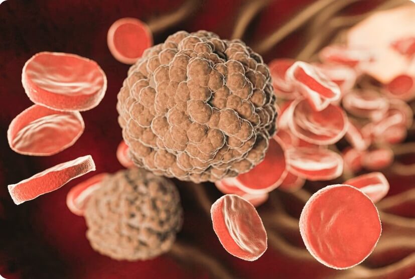 혈관 속 노폐물