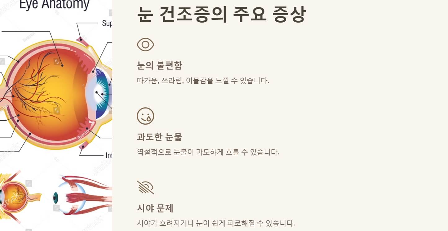 눈 건조증 증상 원인 치료