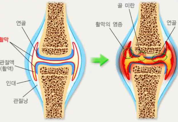 콜라겐의-효능-콜라겐-부작용-건강