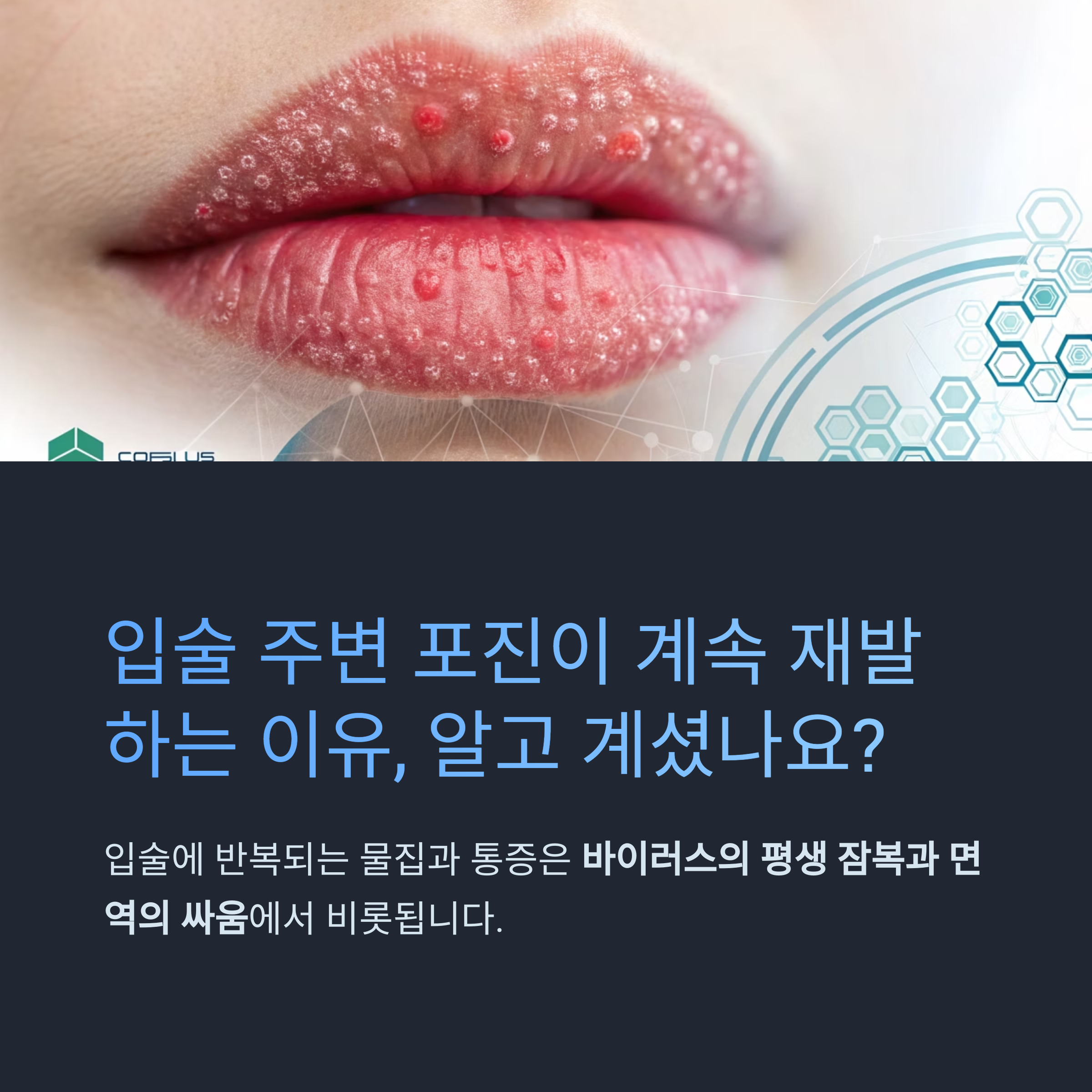 입술 주변 포진