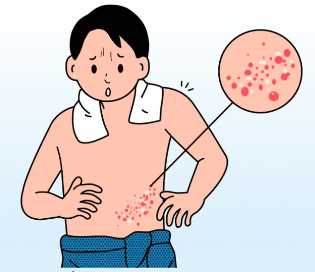2023.대상포진 무료 예방접종.지차체별 대상자 조회.지정의료기관 조회