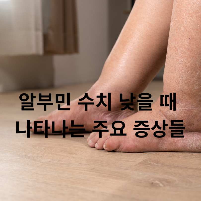 알부민 수치 낮을 때 나타나는 증상, 원인과 관리법