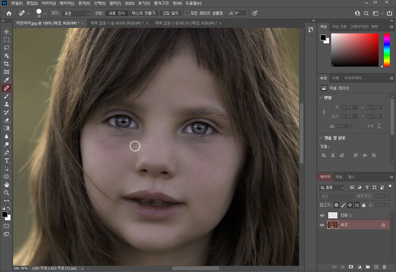 피부 잡티 제거 이미지 2
