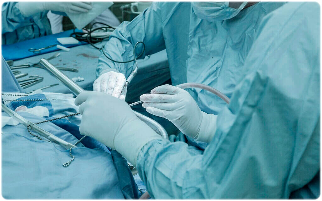 위암 증상 원인 진단 치료 생존율 완치율 예방 방법