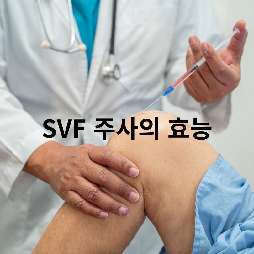 SVF 주사? 무릎 관절염 통증 줄이는 줄기세포 치료법