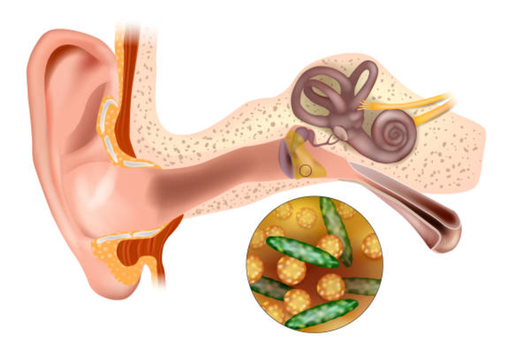이석증과 관련된 사진3