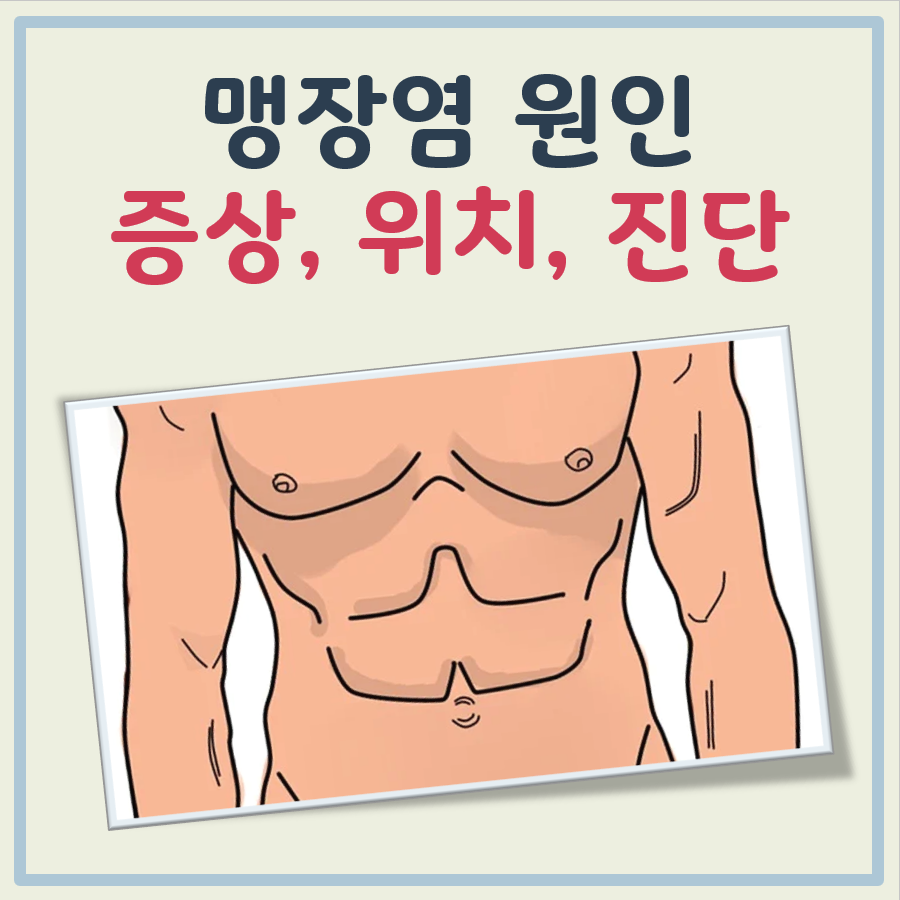 맹장염 원인, 초기증상, 위치, 자가진단 대표 이미지