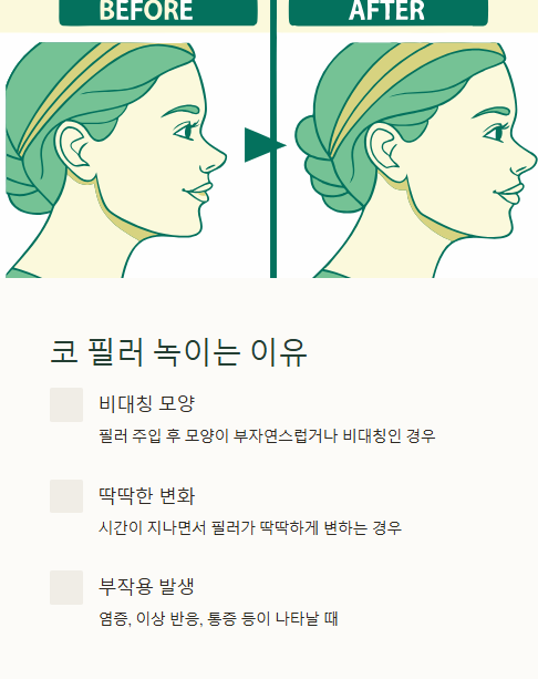 코 필러 녹이는 이유