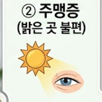 백내장 증상