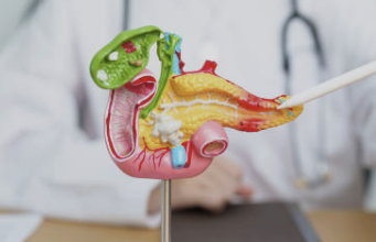 췌장암 초기증상 검사방법 발생원인 총정리(최신)