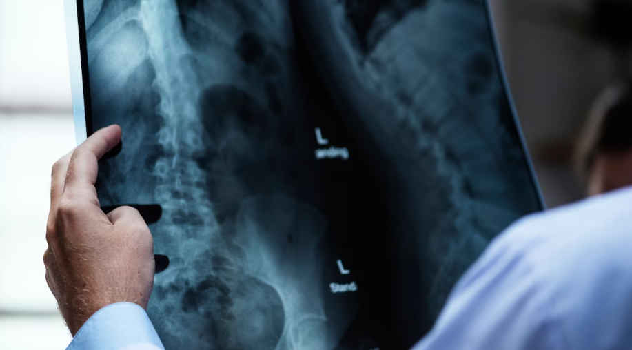 누가 척추측만증의 위험이 있는가?