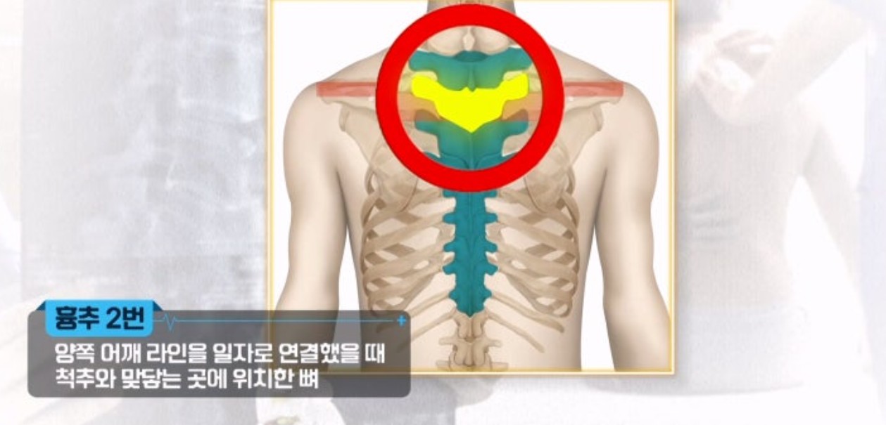불면증 극복