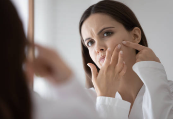 스트레스성 여드름