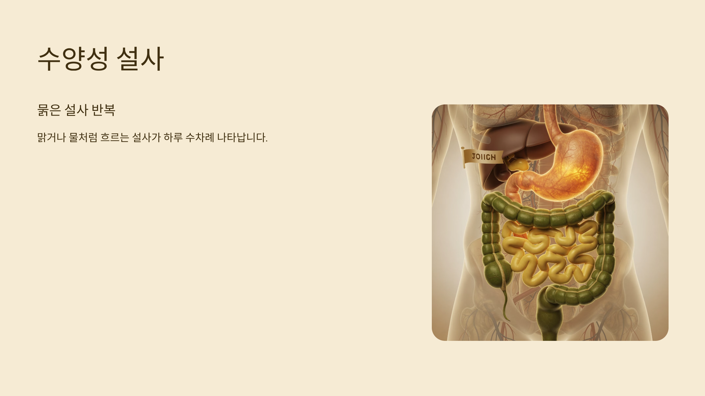 노로 바이러스 장염 증상 수양성 설사