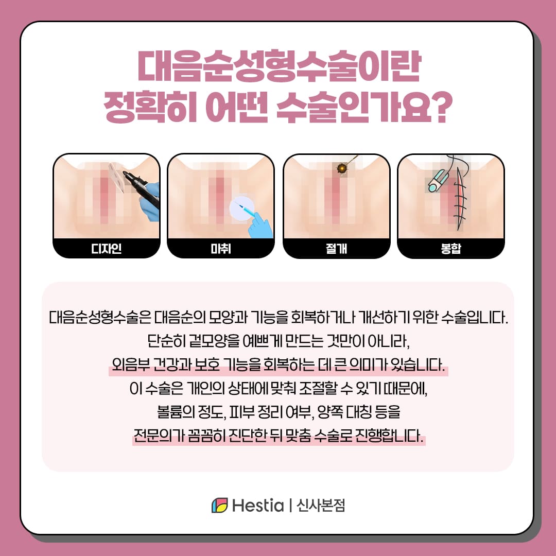 대음순성형수술, 이런 분들께 추천드려요.