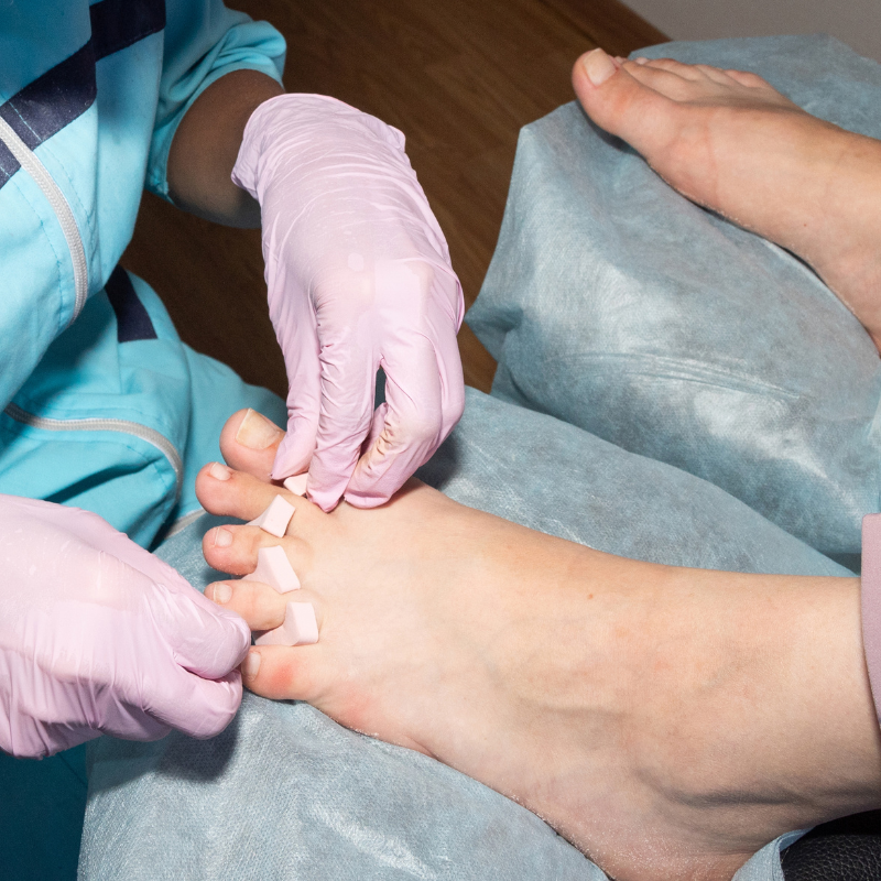 지간신경종 치료