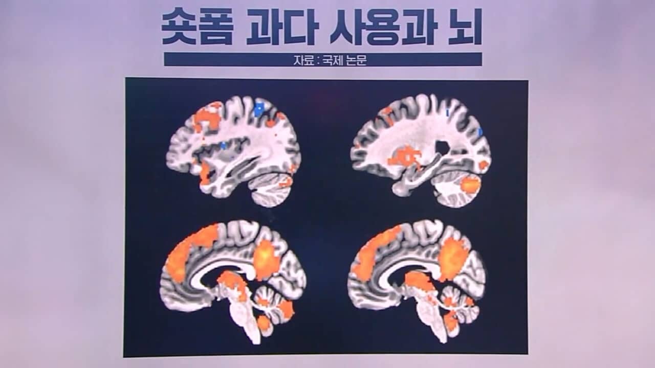 뇌 모양 옆에 작은 노란색 불꽃 아이콘이 그려진 단순한 픽셀 아트.