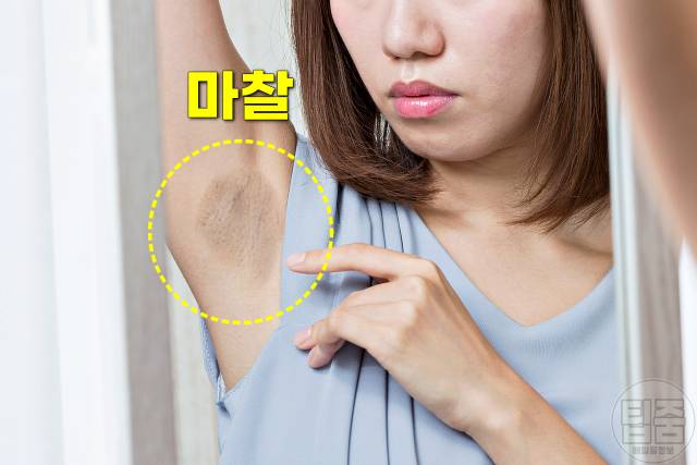 겨드랑이 까만색 착색 원인 겨드랑이 까만 이유