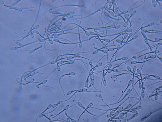 정액이 나오지 않는 이유