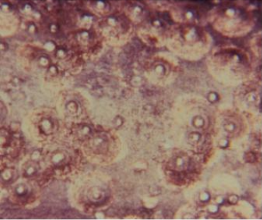 샌호제깍지벌레