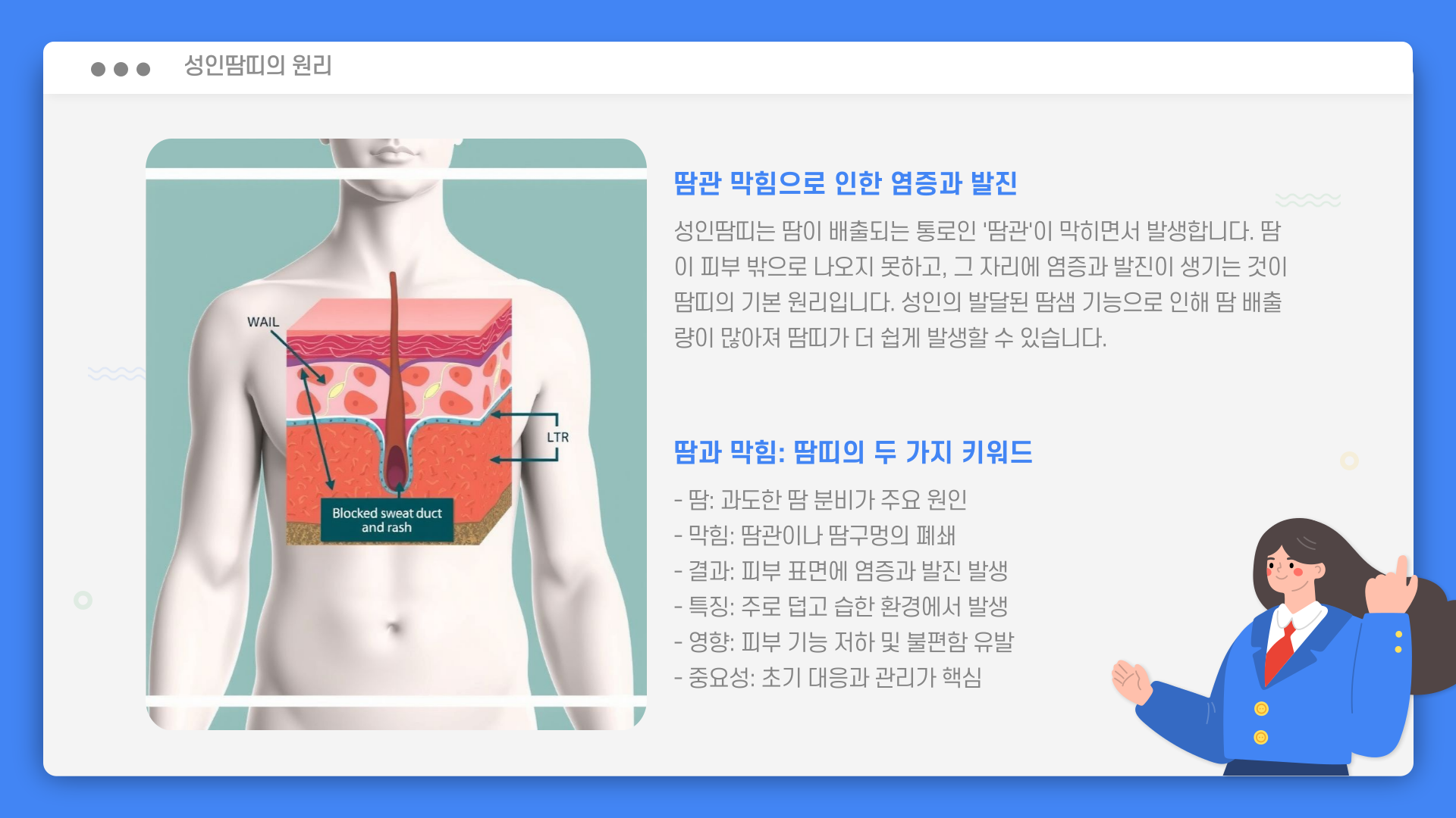 성인땀띠-이유