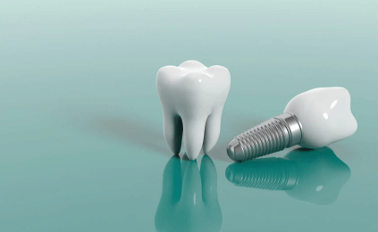 무절개 임플란트 관리법