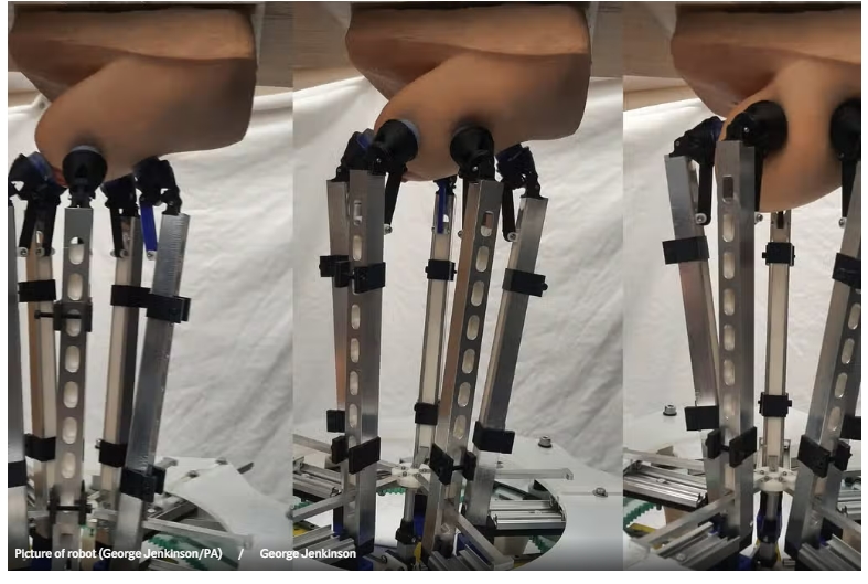브리스톨 대, 유방암 조기 발견 로봇 개발 VIDEO:New robot could help diagnose breast cancer early and &lsquo;revolutionise&rsquo; checks