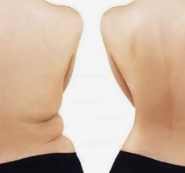 옆구리살-빼는법