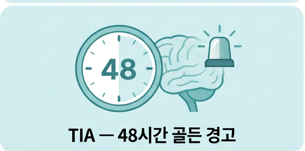 TIA &mdash; '작은 뇌졸중'이라 부르는 이유