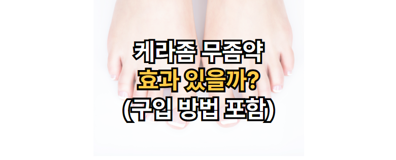 케라좀-무좀약-효과-구입