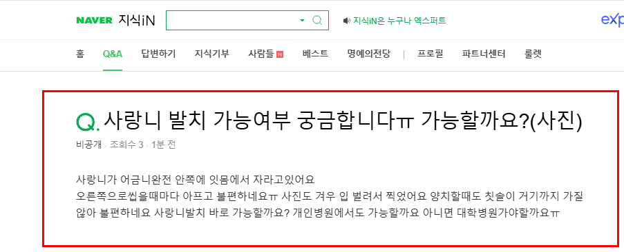 사랑니 발치 가능 여부 질문 지식인