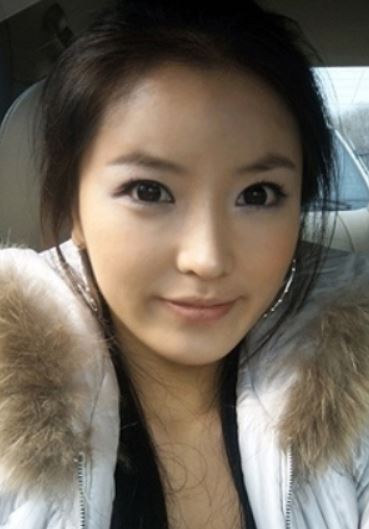 홍진영 과거와 현재 비교 이미지, 성형 고백 관련 맥락