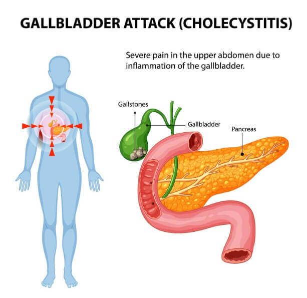 인간의 신체 부위 중 췌장에 대한 설명