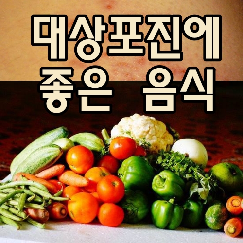 대상포진에 좋은 음식