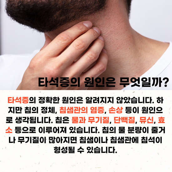 타석증의-원인