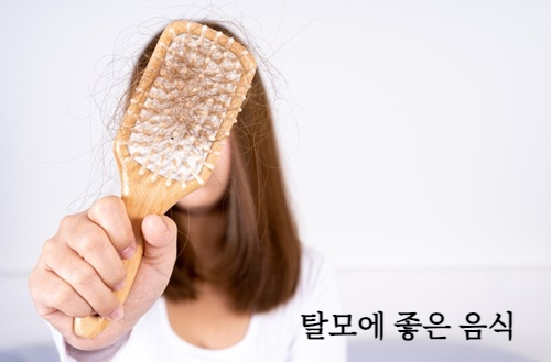 탈모에 좋은 음식 알아보기&amp;#44; 탈모 원인