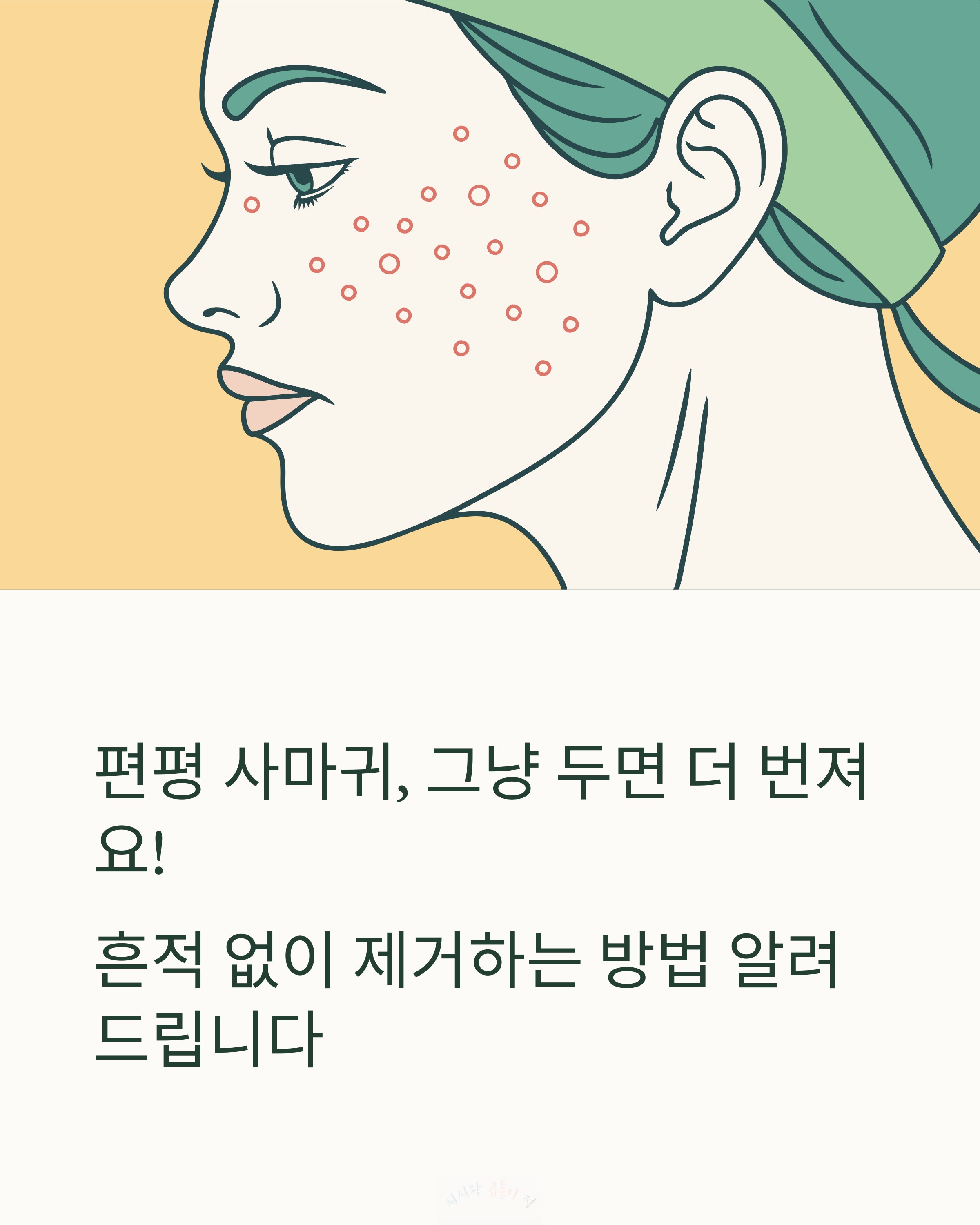 편평 사마귀 그냥 두면 더 번져요