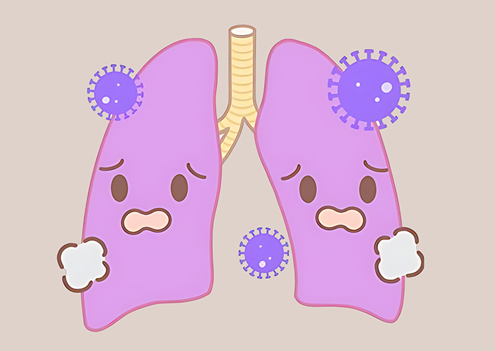 폐렴이-있는-폐모습