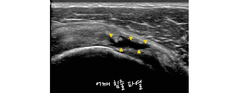 청주 상당구 이비인후과