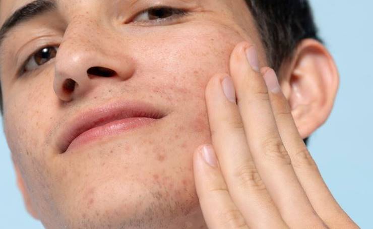 볼을 만지고 있는 남자