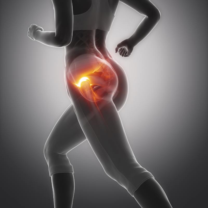 엉덩이 통증 저림 증상 원인