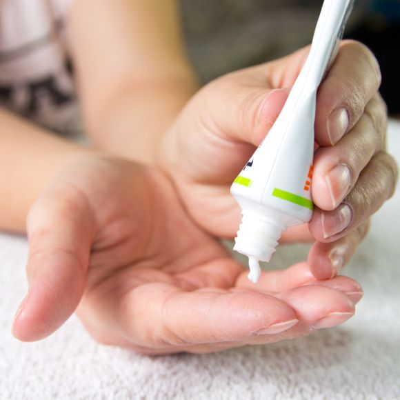 건선 초기 증상