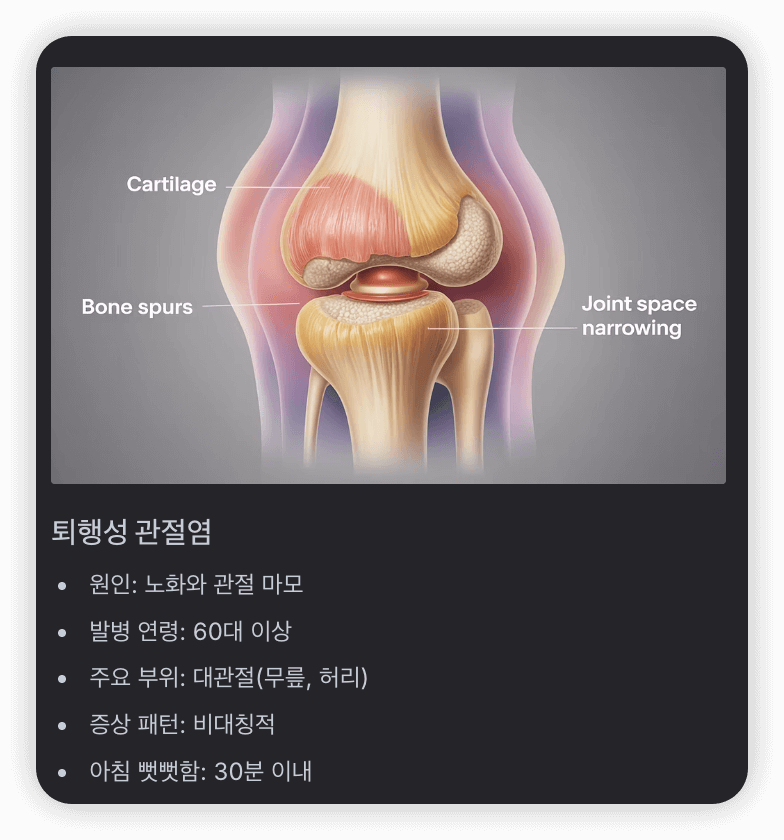 퇴행성-관절염